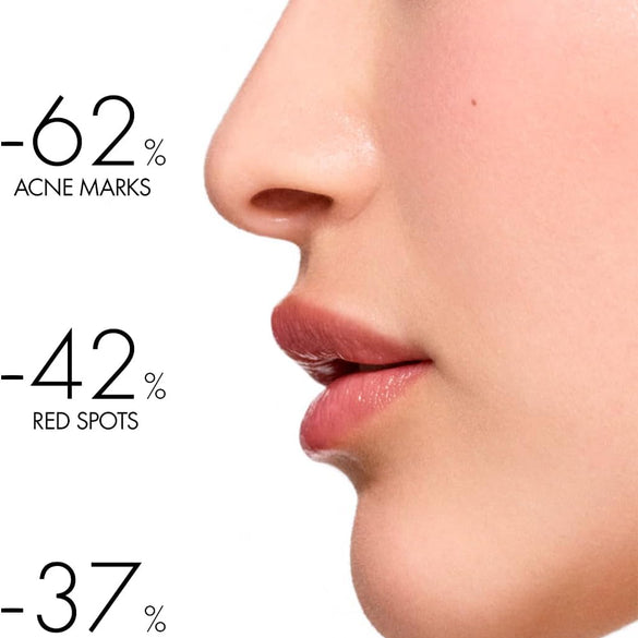 Vichy Normaderm Phytosolution Double Correction Daily Care Moisturiser for Oily & Acne Skin with Salicylic Acid 50ml