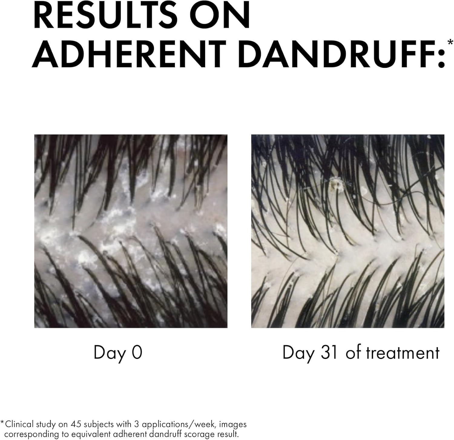 Vichy Dercos Anti Dandruff Shampoo for Dry hair