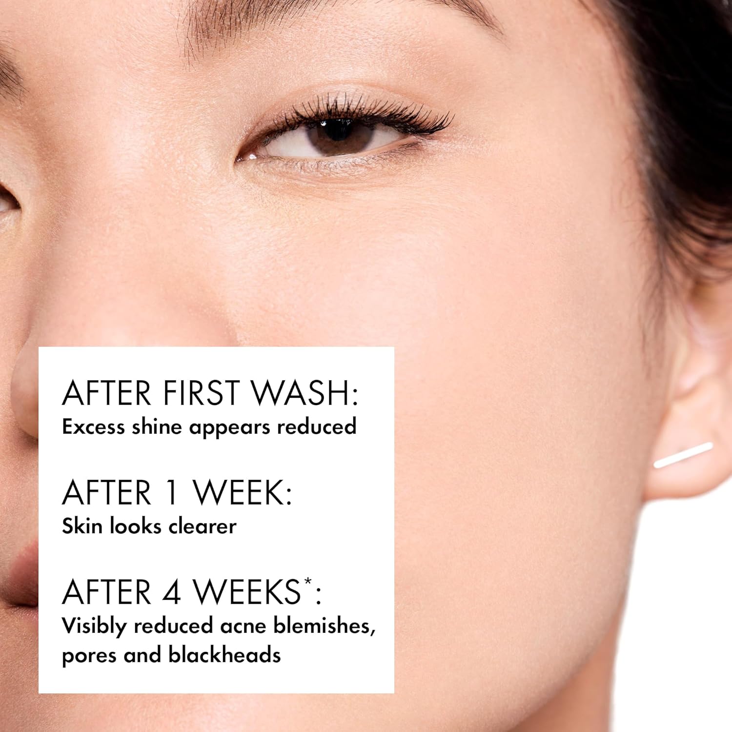 Vichy Normaderm Phytosolution Face Cleanser Gel for Oily/Acne Skin with Salicylic Acid 400ml