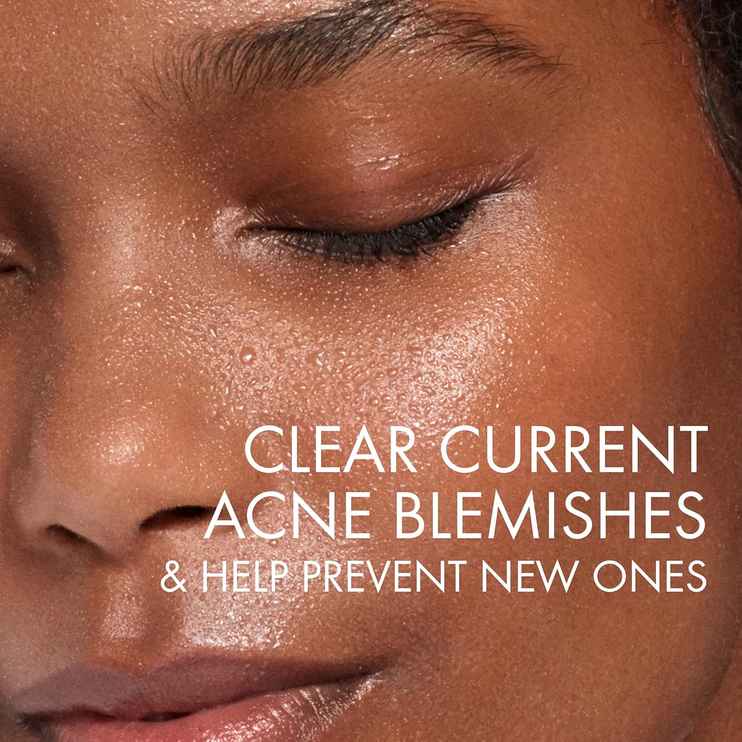 Vichy Normaderm Phytosolution Face Cleanser Gel for Oily/Acne Skin with Salicylic Acid 400ml